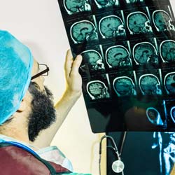 Doctor reading skull / brain xrays. 