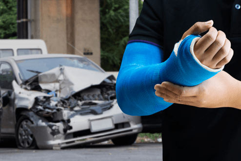 man with broken arm after car accident